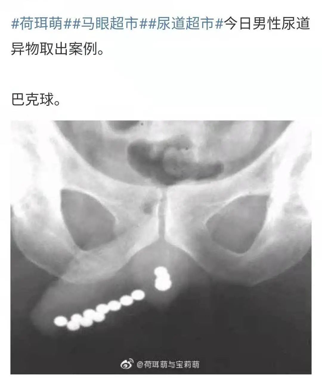 字母圈科普 | 男M们学会保护自己,别往牛子里塞东西!!! 字母圈科普 | 男M们学会保护自己,别往牛子里塞东西!!!