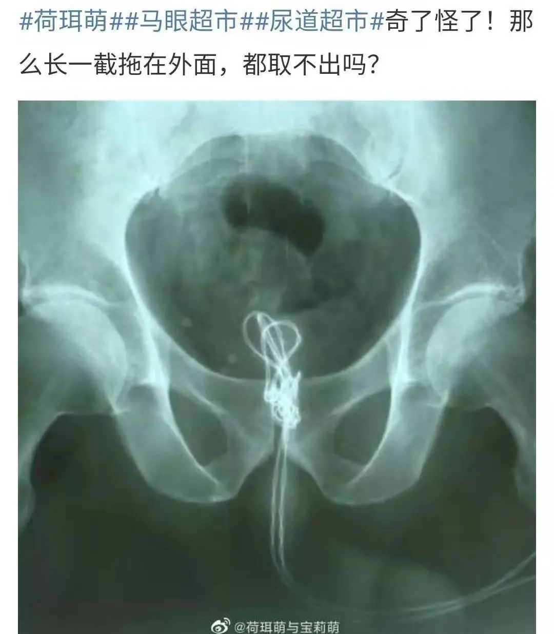 字母圈科普 | 男M们学会保护自己,别往牛子里塞东西!!! 字母圈科普 | 男M们学会保护自己,别往牛子里塞东西!!!