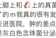 字母圈恋jio,嘴会不会被感染脚气?-瘾欢