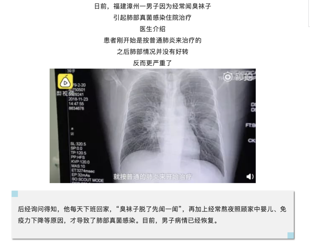 字母圈恋jio,嘴会不会被感染脚气? 字母圈恋jio,嘴会不会被感染脚气?