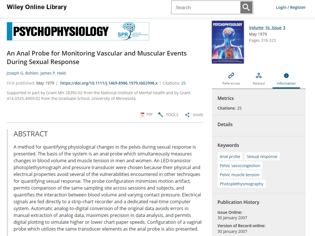 字母圈“我做了一套能监测身体的全自动自罚装置” 字母圈“我做了一套能监测身体的全自动自罚装置”
