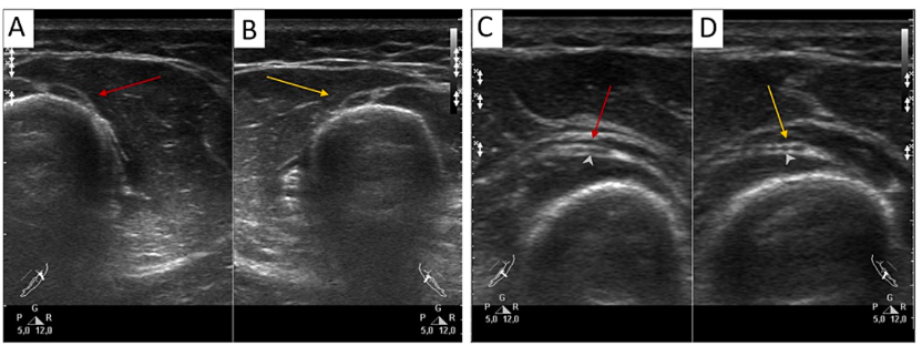 字母圈《绳缚活动中的神经损伤预防指南》 字母圈《绳缚活动中的神经损伤预防指南》