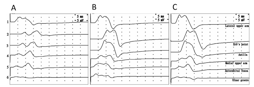 字母圈《绳缚活动中的神经损伤预防指南》 字母圈《绳缚活动中的神经损伤预防指南》