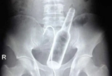 字母圈play之前查一查,别把自己玩噶了——BDSM风险数据库-瘾欢