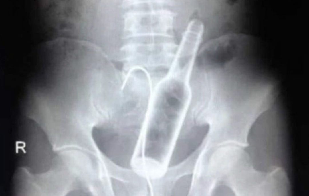 字母圈play之前查一查,别把自己玩噶了——BDSM风险数据库 字母圈play之前查一查,别把自己玩噶了——BDSM风险数据库